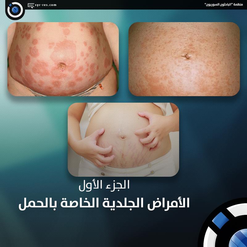 الجلدية الامراض أنواع الأمراض