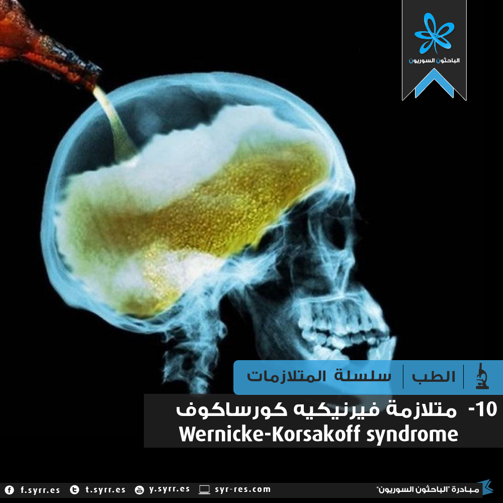 Wernicke Korsakoff Syndrome
